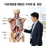 이관개방증 해부학적 구조와 증상 설명 다이어그램